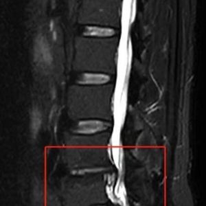 ����Ѳ����ʹ�����С���~�������^���˰a�s�߲���·